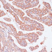 Anti-CDC20 antibody produced in rabbit