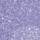 Anti-PATE4 antibody produced in rabbit Prestige Antibodies&#174; Powered by Atlas Antibodies, affinity isolated antibody, buffered aqueous glycerol solution