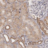Anti-ERBB2 antibody produced in rabbit Ab1, Prestige Antibodies&#174; Powered by Atlas Antibodies, affinity isolated antibody, buffered aqueous glycerol solution