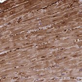 Anti-FABP3 antibody produced in rabbit Prestige Antibodies&#174; Powered by Atlas Antibodies, affinity isolated antibody, buffered aqueous glycerol solution