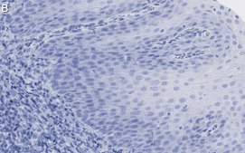 Anti-FAM49A Antibody, clone 2D6 ZooMAb&#174; Rabbit Monoclonal recombinant, expressed in HEK 293 cells