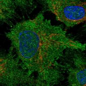 Anti-DCHS1 antibody produced in rabbit Prestige Antibodies&#174; Powered by Atlas Antibodies, affinity isolated antibody, buffered aqueous glycerol solution
