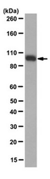 Anti-Isocitrate Dehydrogenase 1 (IDH1)-R132H Antibody, clone HMab-1 clone HMab-1, from mouse