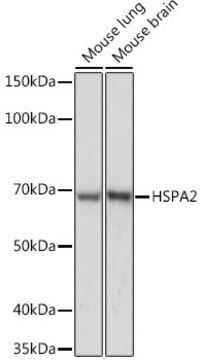 Anti-HSPA2 Antibody, clone 5C9X0, Rabbit Monoclonal