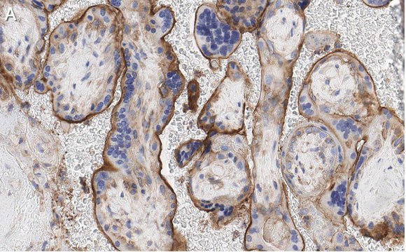 Anti-GNA-11 (G alpha 11) Antibody, clone 1F16 ZooMAb&#174; Rabbit Monoclonal recombinant, expressed in HEK 293 cells