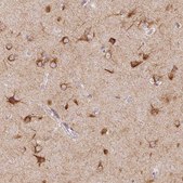 Anti-SEZ6L2 antibody produced in rabbit Prestige Antibodies&#174; Powered by Atlas Antibodies, affinity isolated antibody, buffered aqueous glycerol solution