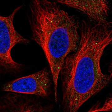 Anti-DNAJC22 antibody produced in rabbit Prestige Antibodies&#174; Powered by Atlas Antibodies, affinity isolated antibody