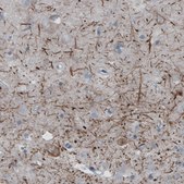 Monoclonal Anti-NEFH antibody produced in mouse Prestige Antibodies&#174; Powered by Atlas Antibodies, clone CL2671, purified immunoglobulin, buffered aqueous glycerol solution