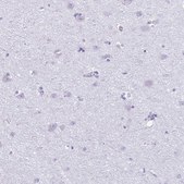 Anti-PRM2 antibody produced in rabbit Prestige Antibodies&#174; Powered by Atlas Antibodies, affinity isolated antibody, buffered aqueous glycerol solution