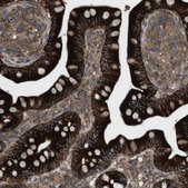 Anti-DDAH2 antibody produced in rabbit Prestige Antibodies&#174; Powered by Atlas Antibodies, affinity isolated antibody, buffered aqueous glycerol solution