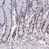 Anti-MKI67 antibody produced in rabbit Ab1, Prestige Antibodies&#174; Powered by Atlas Antibodies, affinity isolated antibody, buffered aqueous glycerol solution