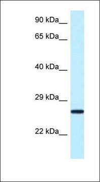 Anti-NUDT16 antibody produced in rabbit affinity isolated antibody