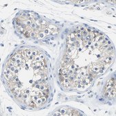 Anti-PPP3CA antibody produced in rabbit Prestige Antibodies&#174; Powered by Atlas Antibodies, affinity isolated antibody, buffered aqueous glycerol solution