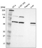 Anti-PI4KB antibody produced in rabbit Ab1, Prestige Antibodies&#174; Powered by Atlas Antibodies, affinity isolated antibody, buffered aqueous glycerol solution