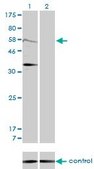 Monoclonal Anti-MDM2 antibody produced in mouse clone 1A7, purified immunoglobulin, buffered aqueous solution