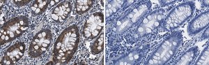 Anti-FBXO38 Antibody, clone 1I18 ZooMAb&#174; Rabbit Monoclonal recombinant, expressed in HEK 293 cells