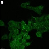 Anti-GPR146 Antibody, clone 1F6 ZooMAb&#174; Rabbit Monoclonal recombinant, expressed in HEK 293 cells