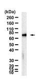 Anti-ZAP-70 Antibody, clone 1D9 ZooMAb&#174; Rabbit Monoclonal recombinant, expressed in HEK 293 cells