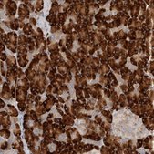 Anti-NXT2 antibody produced in rabbit Prestige Antibodies&#174; Powered by Atlas Antibodies, affinity isolated antibody, buffered aqueous glycerol solution
