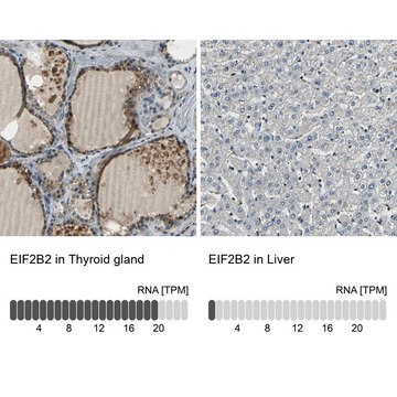 Anti-EIF2B2 antibody produced in rabbit Prestige Antibodies&#174; Powered by Atlas Antibodies, affinity isolated antibody, buffered aqueous glycerol solution