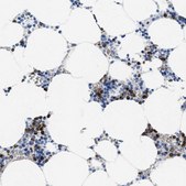 Anti-MMP8 antibody produced in rabbit Prestige Antibodies&#174; Powered by Atlas Antibodies, affinity isolated antibody, buffered aqueous glycerol solution, Ab2