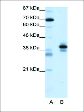 Anti-PITX1 antibody produced in rabbit IgG fraction of antiserum