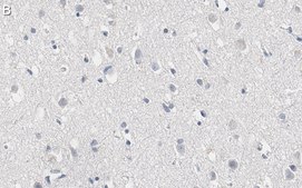 Anti-RNA polymerase II Antibody, clone CTD4H8 ZooMAb&#174; Mouse Monoclonal recombinant, expressed in HEK 293 cells