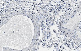 Anti-Elastin Antibody, clone 1G6 ZooMAb&#174; Rabbit Monoclonal recombinant, expressed in HEK 293 cells