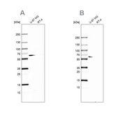 Anti-P4HA2 antibody produced in rabbit Prestige Antibodies&#174; Powered by Atlas Antibodies, affinity isolated antibody, buffered aqueous glycerol solution