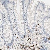 Anti-NFKBIZ antibody produced in rabbit Prestige Antibodies&#174; Powered by Atlas Antibodies, affinity isolated antibody, buffered aqueous glycerol solution