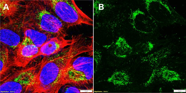 Anti-Mucolipin-1 Antibody, clone 1D9 ZooMAb&#174; Rabbit Monoclonal recombinant, expressed in HEK 293 cells