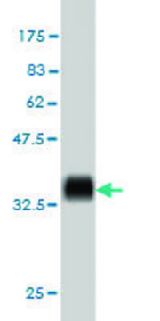 ANTI-KIT antibody produced in mouse clone 1G1, purified immunoglobulin, buffered aqueous solution