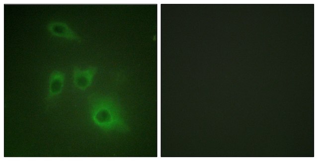 Anti-HSP90B antibody produced in rabbit affinity isolated antibody