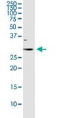 Anti-NQO1 antibody produced in rabbit purified immunoglobulin, buffered aqueous solution