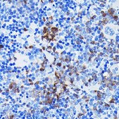 Anti-BTK antibody produced in rabbit