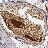 Anti-C1QC antibody produced in rabbit Prestige Antibodies&#174; Powered by Atlas Antibodies, affinity isolated antibody, buffered aqueous glycerol solution