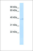 Anti-SIRT4 antibody produced in rabbit affinity isolated antibody