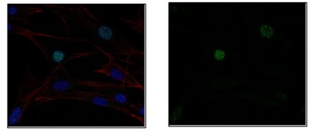 Anti-E3 ubiquitin-protein ligase UHRF1, clone BF18.11 Antibody clone BF18.11, from mouse