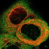 Anti-STAT2 antibody produced in rabbit Prestige Antibodies&#174; Powered by Atlas Antibodies, affinity isolated antibody, buffered aqueous glycerol solution