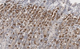 Anti-IKB &#945; Antibody, clone 6O8, ZooMAb&#174; Rabbit Monoclonal recombinant, expressed in HEK 293 cells