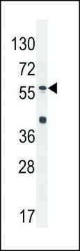 ANTI-SP8 (C-TERM) antibody produced in rabbit IgG fraction of antiserum, buffered aqueous solution