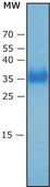SARS-CoV-2 Receptor Binding Domain Spike protein RBD recombinant, expressed in HEK 293 cells