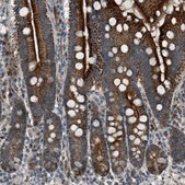 Anti-VPS41 antibody produced in rabbit Prestige Antibodies&#174; Powered by Atlas Antibodies, affinity isolated antibody, buffered aqueous glycerol solution, Ab1