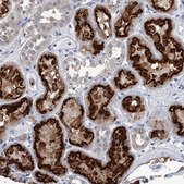 Anti-PDXK antibody produced in rabbit Prestige Antibodies&#174; Powered by Atlas Antibodies, affinity isolated antibody, buffered aqueous glycerol solution, ab3