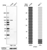 Anti-STIM1 antibody produced in rabbit Prestige Antibodies&#174; Powered by Atlas Antibodies, affinity isolated antibody, buffered aqueous glycerol solution