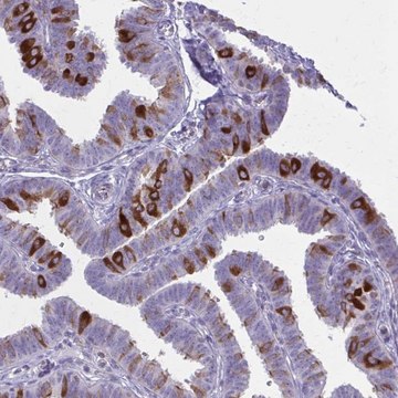 Anti-PITPNM1 antibody produced in rabbit Prestige Antibodies&#174; Powered by Atlas Antibodies, affinity isolated antibody, buffered aqueous glycerol solution