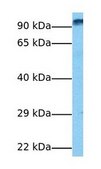 Anti-WDFY3 antibody produced in rabbit affinity isolated antibody