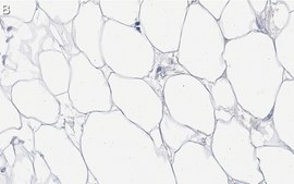 Anti-FASN Antibody, clone 2C13 ZooMAb&#174; Rabbit Monoclonal recombinant, expressed in HEK 293 cells