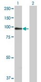 Anti-ACTN1 antibody produced in rabbit purified immunoglobulin, buffered aqueous solution