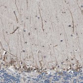 Anti-CLCC1 antibody produced in rabbit Ab1, Prestige Antibodies&#174; Powered by Atlas Antibodies, affinity isolated antibody, buffered aqueous glycerol solution